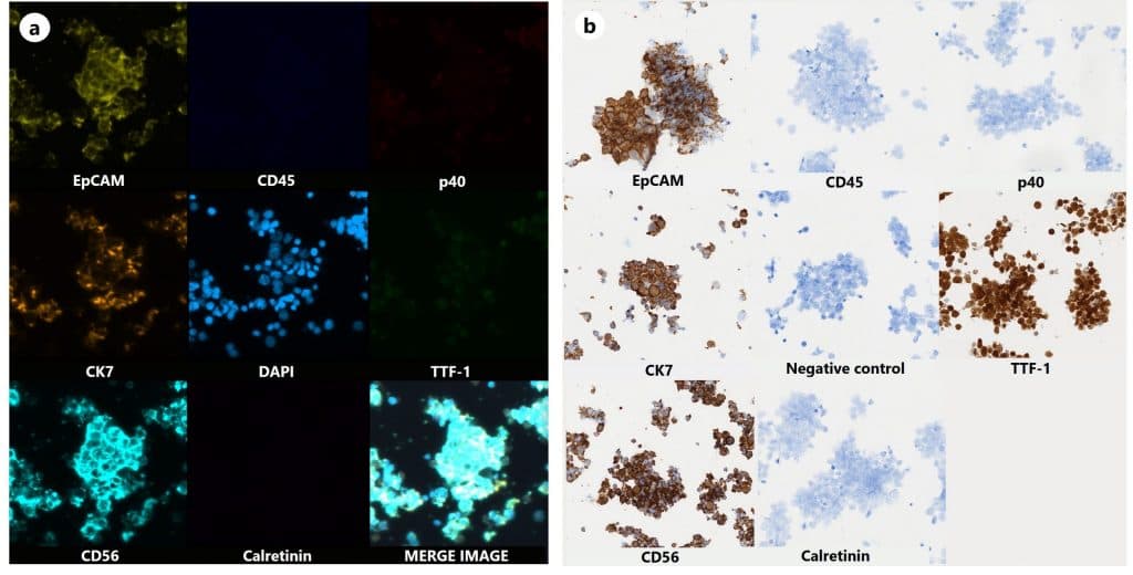 New publication highlights potential of multiplexing in effusion and FNA cytology