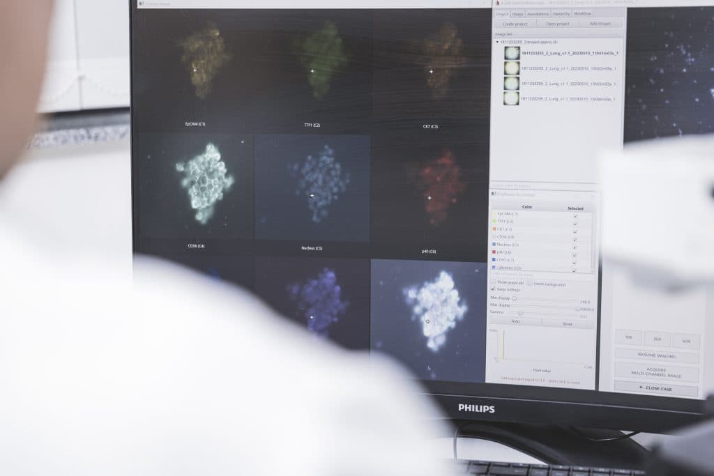 X-ZELL enabling same-day diagnoses at German routine laboratory