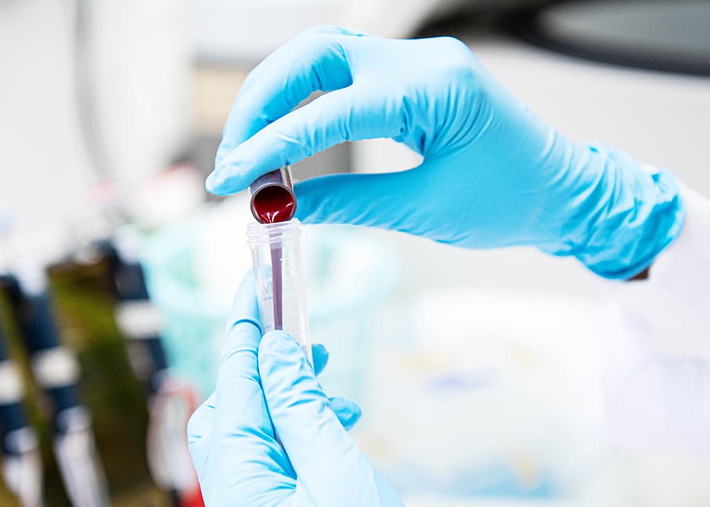 World-first cancer screening technology trialled in Singapore
